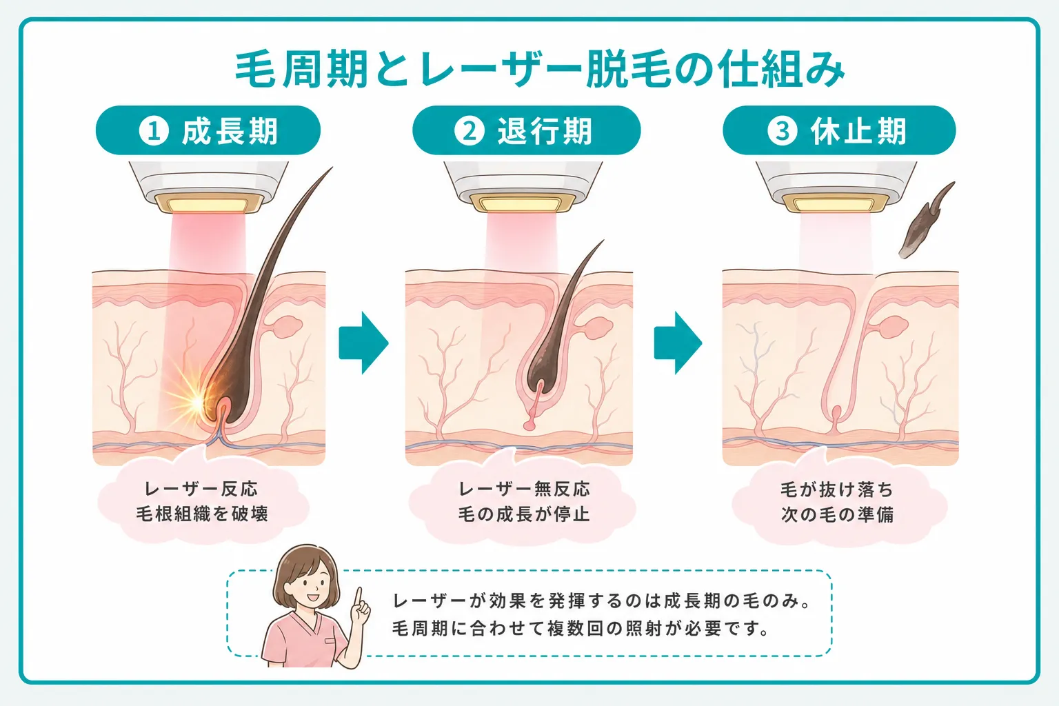 メンズ医療脱毛の効果が出やすい回数と毛周期の関係